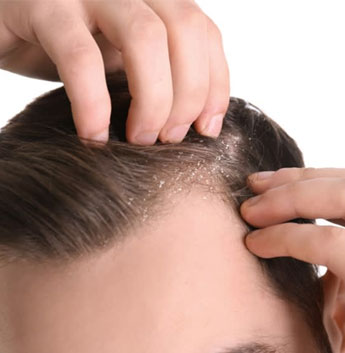 Hair Coloring